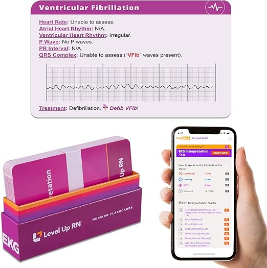 EKG Interpretation Flash Cards – for Nursing/EMT/Paramedic School – 2025-2026 NCLEX ATI HESI Review LPN RN Flash Cards (45 Cards)