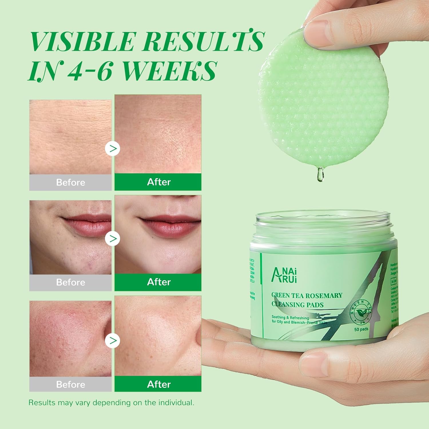 ANAI RUI Green Tea Rosemary Cleansing Pads with CICA Tea Tree Oil, Face Scrub Pads with Bubbles, Exfoliating Deep Cleansing Pad for Face and Body, Make-up Remover Wipes, 50pcs - Image 7