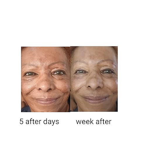 Miniatura 3 de Mejor ácido hialurónico avanzado + vitamina B3 (niacinamida) Eficiente abrillantador facial antienvejecimiento orgánico antiwinkles, suero de