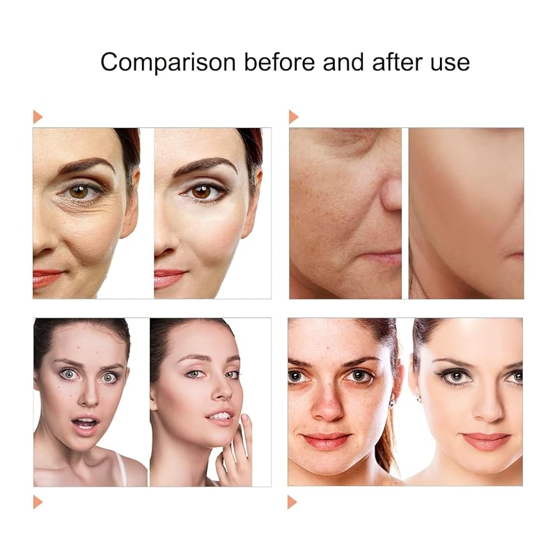 Caweiya 7 Color LED Face Mask LED Light Therapy Equipment for Skin Care at Home Beauty Salon Equipment image 5