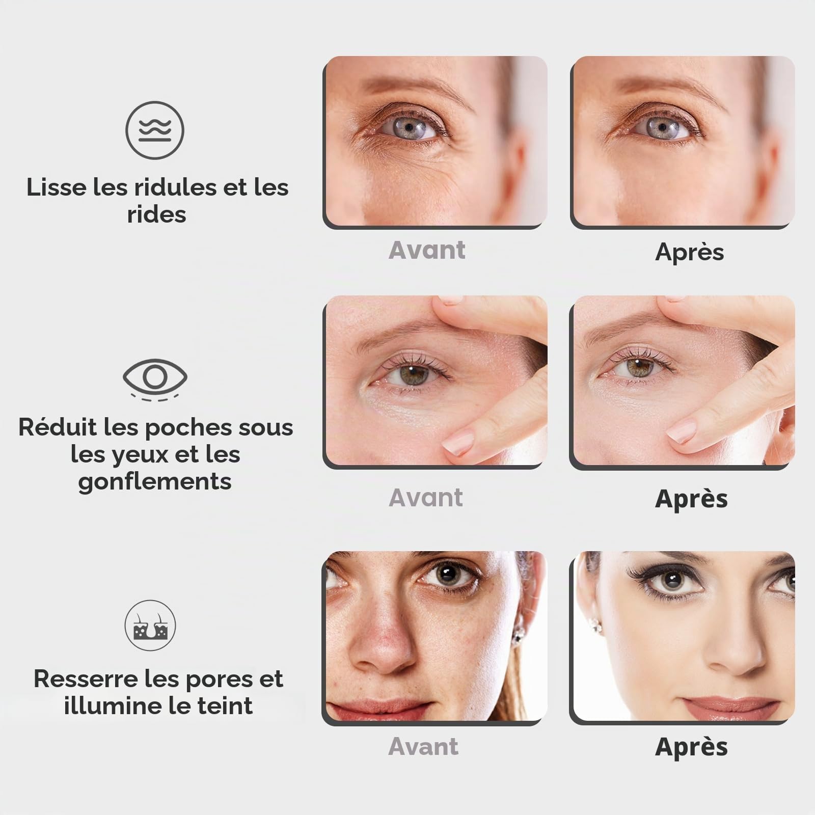 Glaçons incassables en acier inoxydable pour le visage, le cou et les yeux, bâtons cryogéniques pour soins de la peau, ciblent les cernes, les poches, les rides et les productions de collagène, blanc