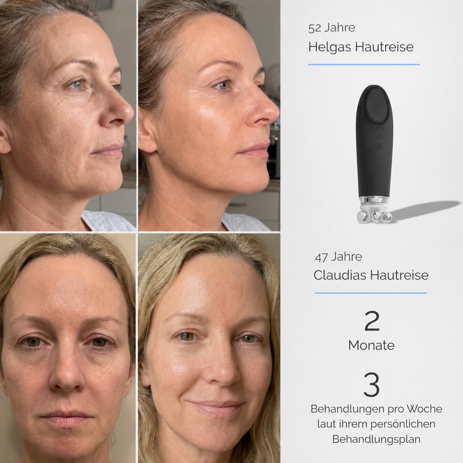 Vinvi Dermaglow Gesichtspflegegerät, 4-in-1 Beauty Tool mit Wärme, Mikrovibration, Massage- und Reinigungsaufsätzen, Porenreiniger und Gesichtsmassagegerät für Zuhause (Schwarz)