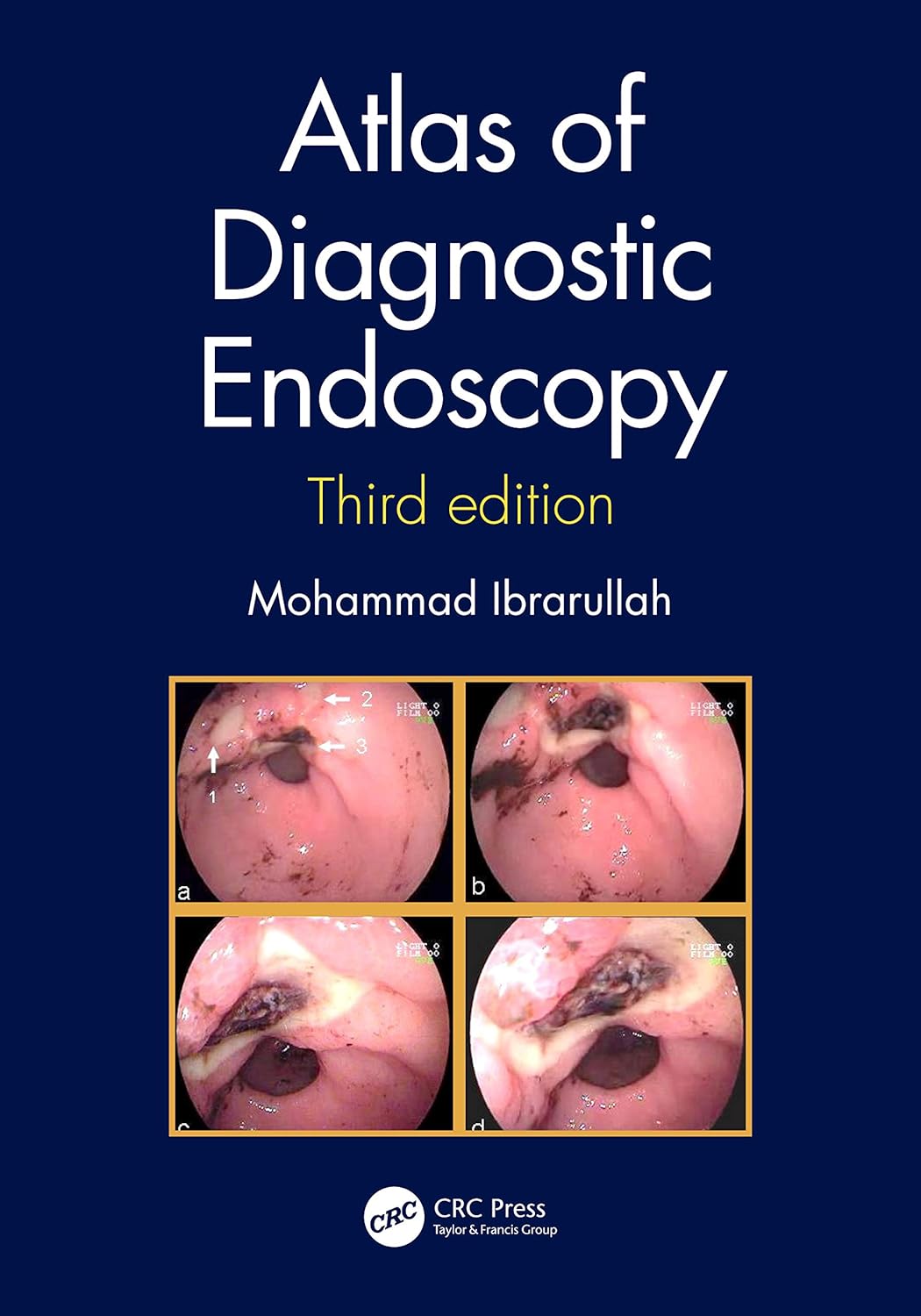 Buy Atlas of Diagnostic Endoscopy, 3E Book Online at Low Prices in
