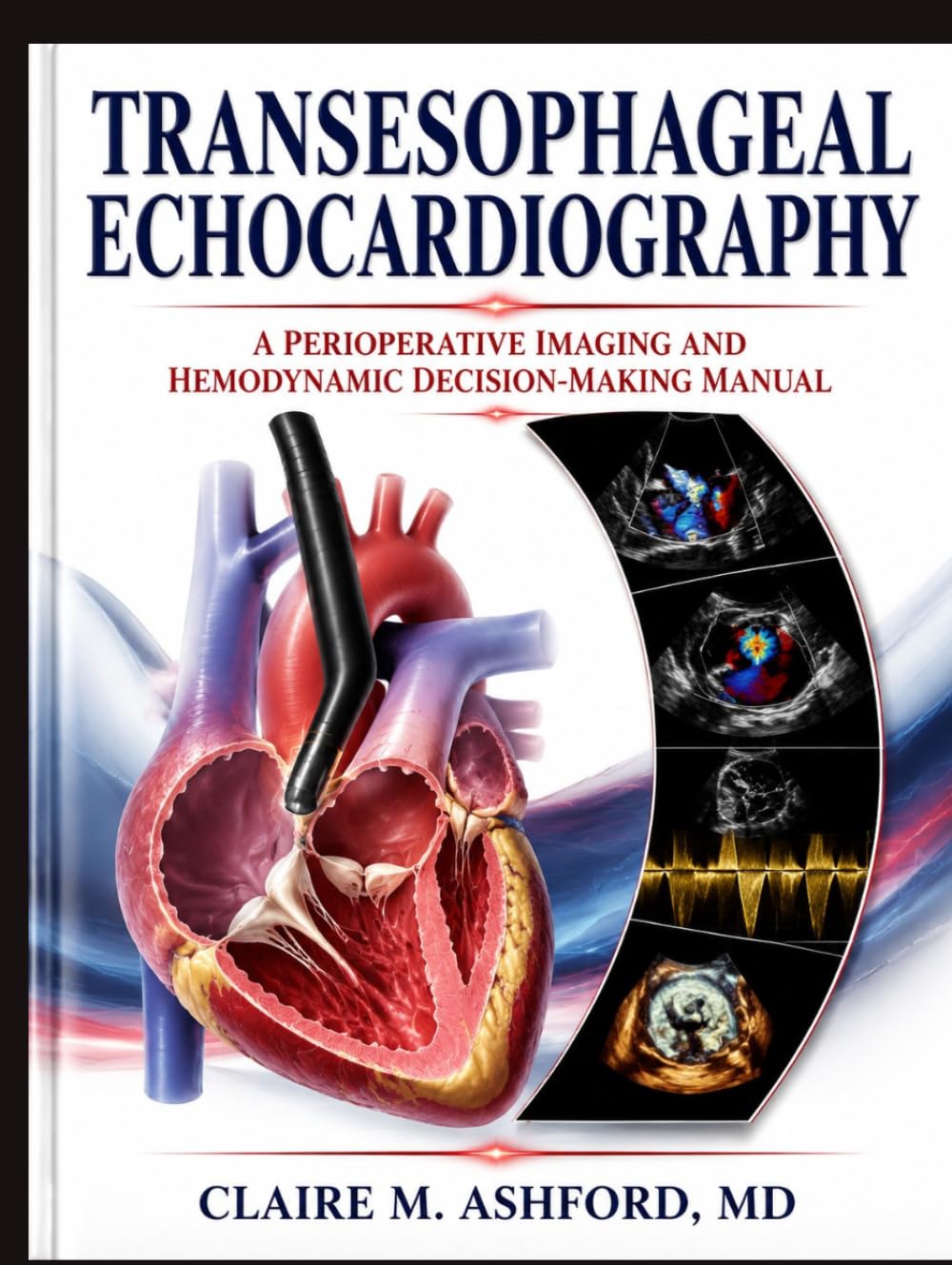 Transesophageal Echocardiography: A Perioperative Imaging and Hemodynamic Decision-Making Manual