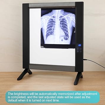 X-ray Film Illuminator Light Box, X-Ray LED Viewbox, X-Ray Viewer Light Panel for Hospital X-Film or CT-Film Lab Equipment(19x20in/48x50.5cm)