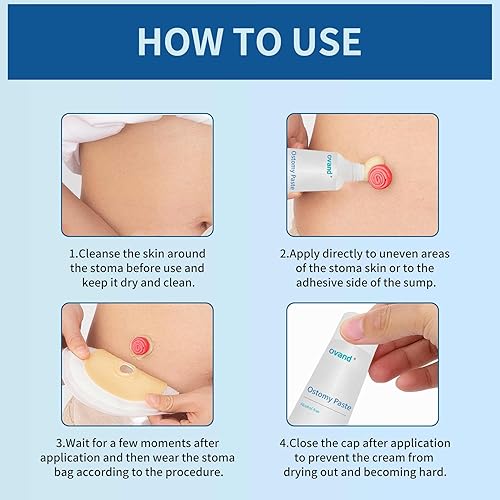 Miniatura 4 de Pasta de ostomía, barrera cutánea sin alcohol para relleno de estoma para evitar fugas, suministros para el cuidado del estoma (2 cajas)