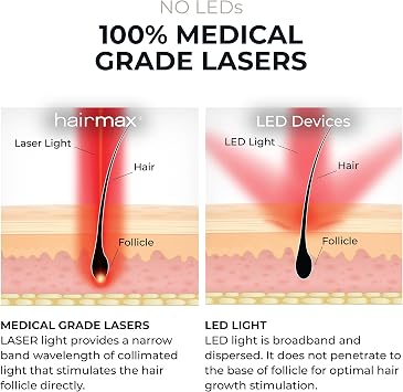 HairMax Ultima 9 Classic LaserComb (FDA Cleared) Hair Growth Device. Stimulates Hair Growth, Reverses Thinning, Regrows Denser, Fuller Hair. Targeted Hair Loss Treatment. | Reverse Thinning Hair, For Men & Women, with 100% Medical Grade Lasers