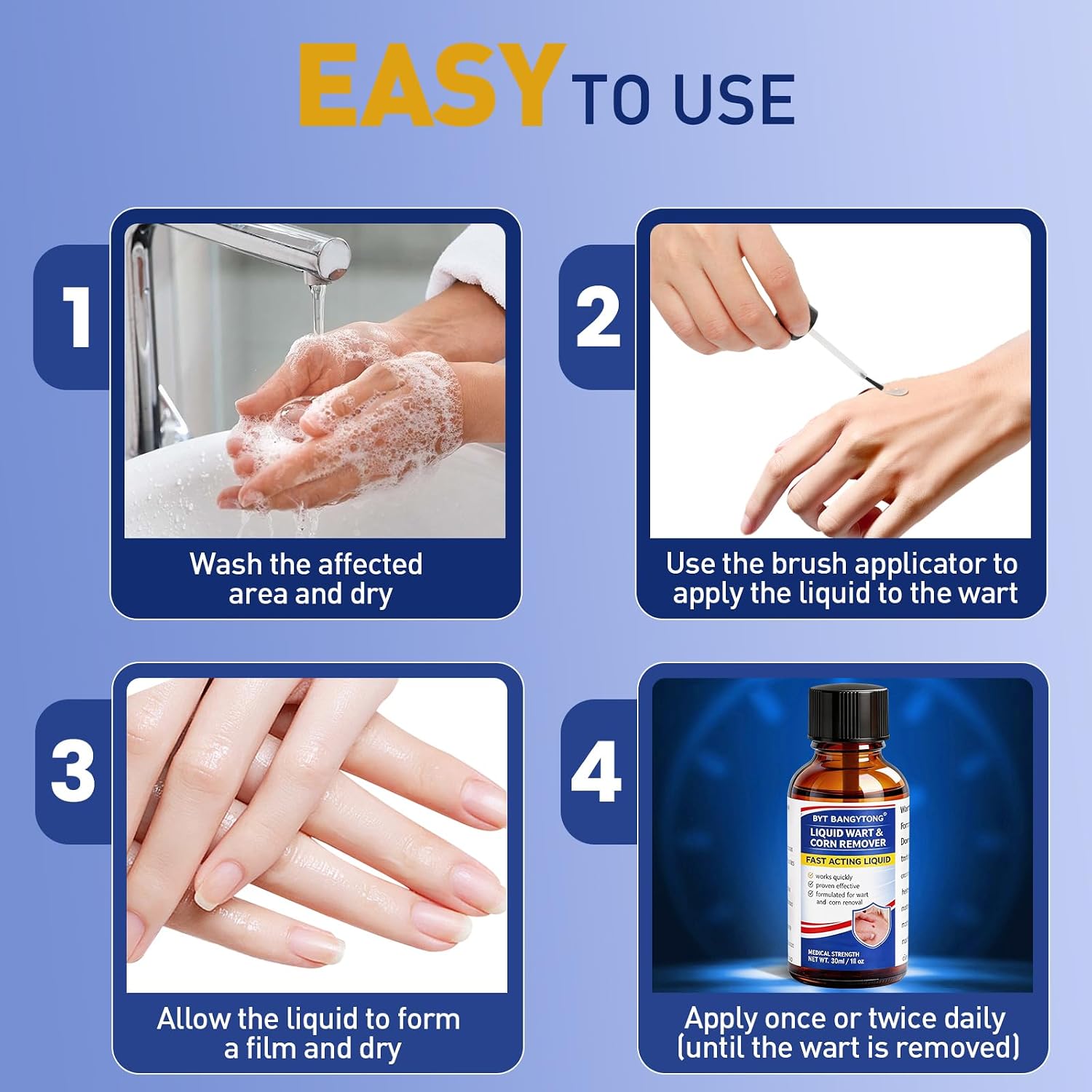 Wart Remover Liquid - Gentle Formula for Plantar Warts, Common & Corn on Feet, Hands and Other External Areas - 17% Salicylic Acid - NET WT: 30ml/ 1fl oz