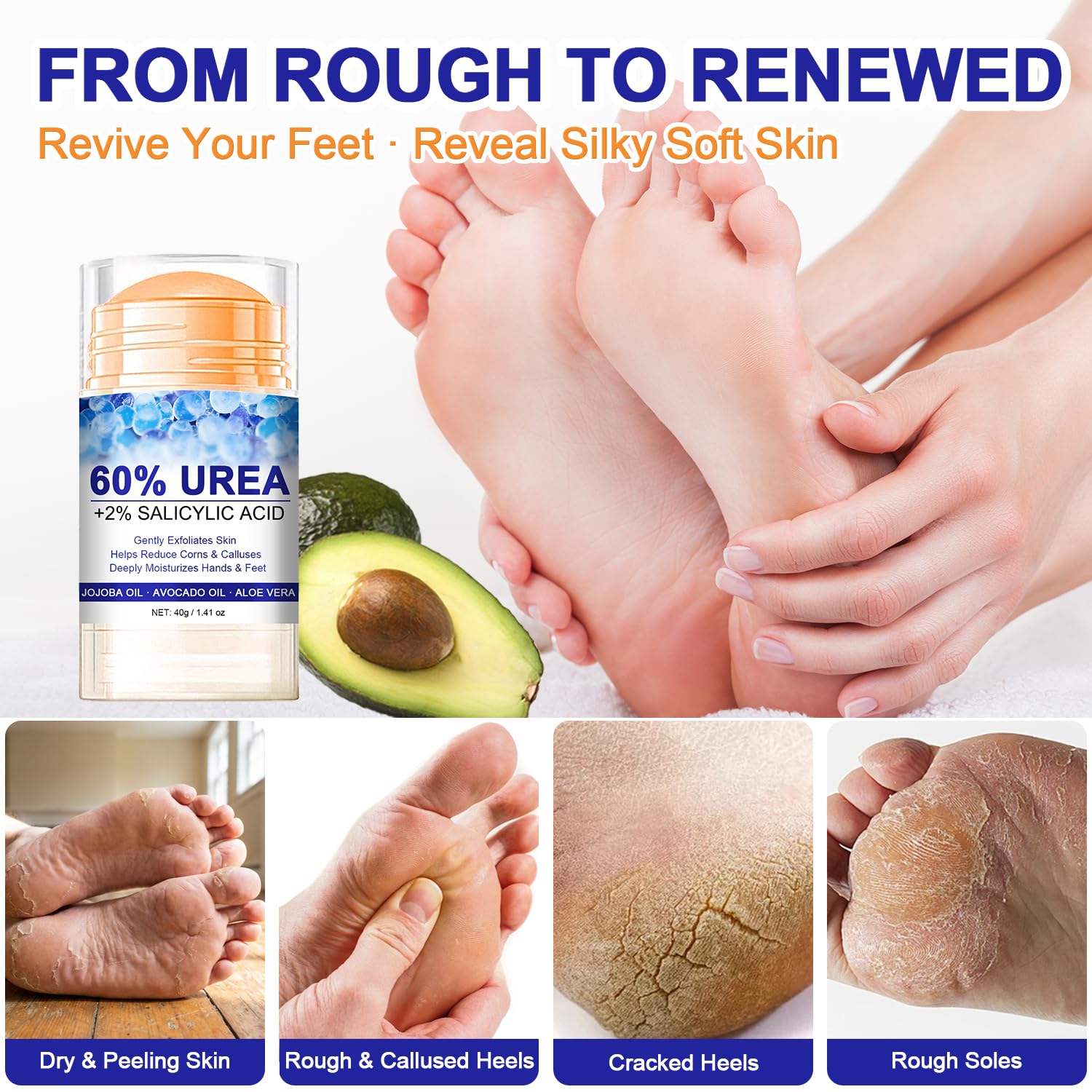 60% Urea with 2% Salicylic Acid Urea Foot Care Stick, Foot Cream Moisturizer for Dry Cracked Feet, Knees, Elbows, Hands,Moisturizes and Hydrates the Dry Skin,Callus Remover & Skin Softener -1.41oz