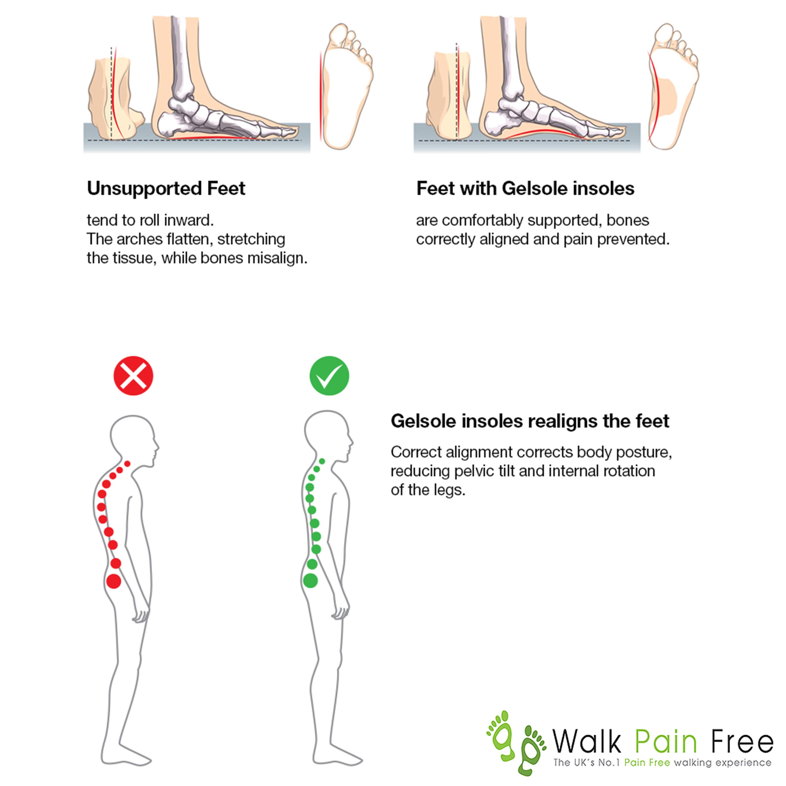 Solette Ortopediche in Gel, Tecnologia Magnetica Potenziata Solette Comfort | Ridurre Il Dolore al Tallone, la fascite Plantare, i Piedi Piatti | Fornitura di Servizi Sanitari e di