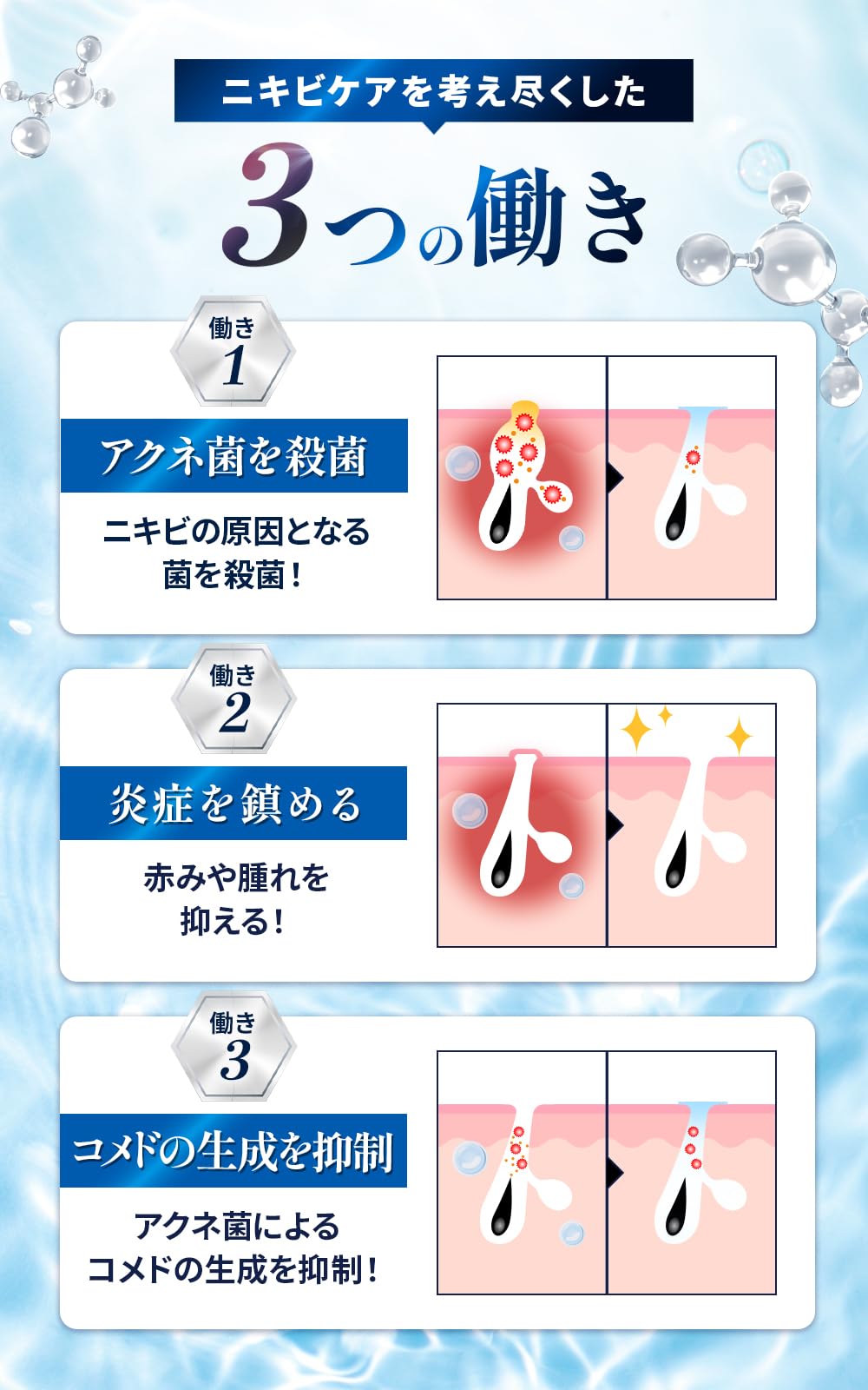 Amazon | 【第2類医薬品】アラジル ニキビ治療薬 24g | アラジル