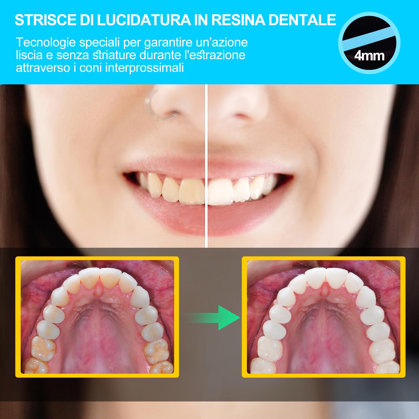 AISEELY Strisce Sbiancanti Denti, Sbiancante Denti di Strisce per Lucidatura Dentale, 1pcs 6m/Rotoli/Scatola di Carta Vetrata per Pulizia Denti, 4mm di Spessore Sbiancante Denti Professionale Kit