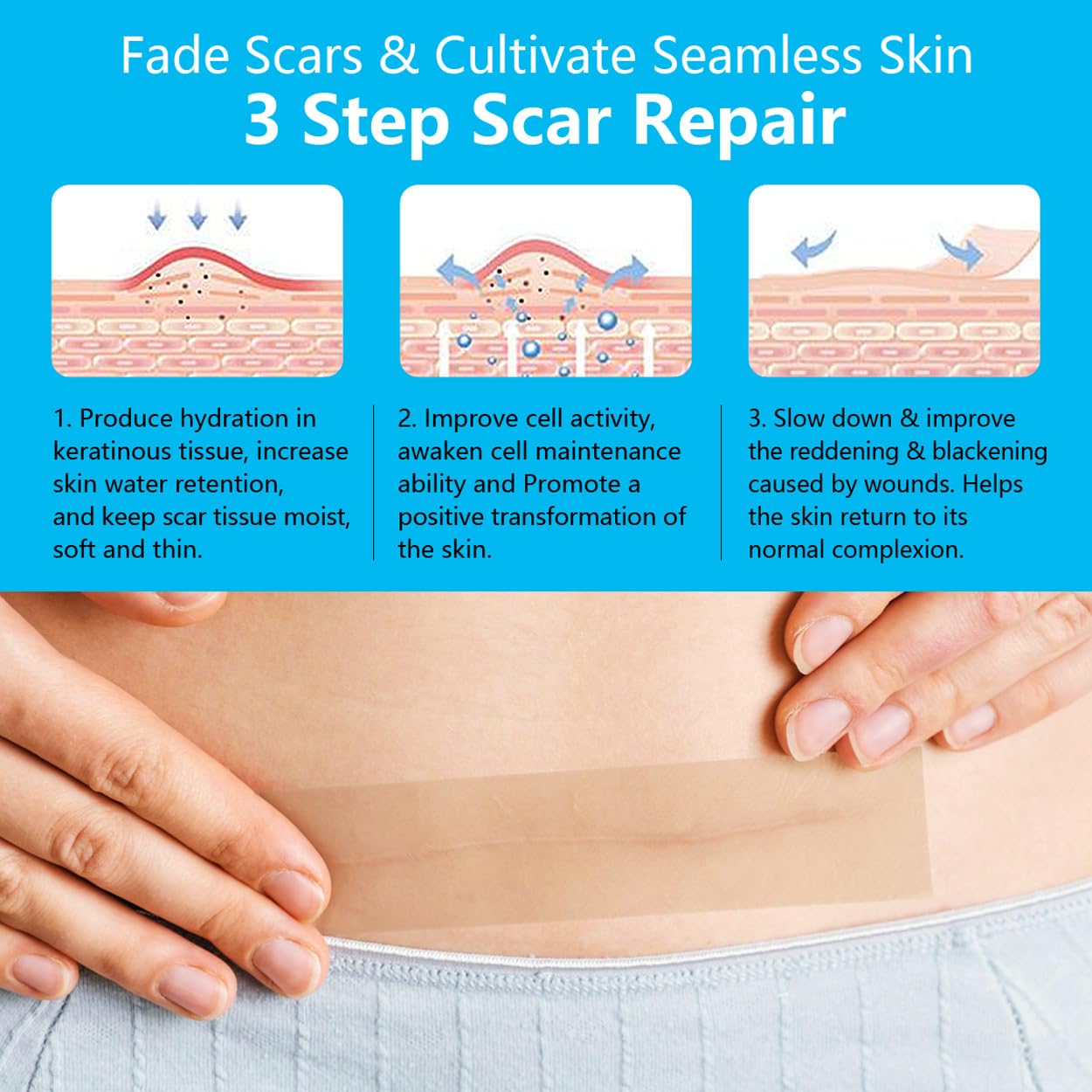 Reusable Silicone Scar Sheets (1.6"x60") - Medical Grade Scar Gel for C-Section, Keloid, Burn & Surgical Scars, Waterproof & Skin-Friendly Strips - Image 4
