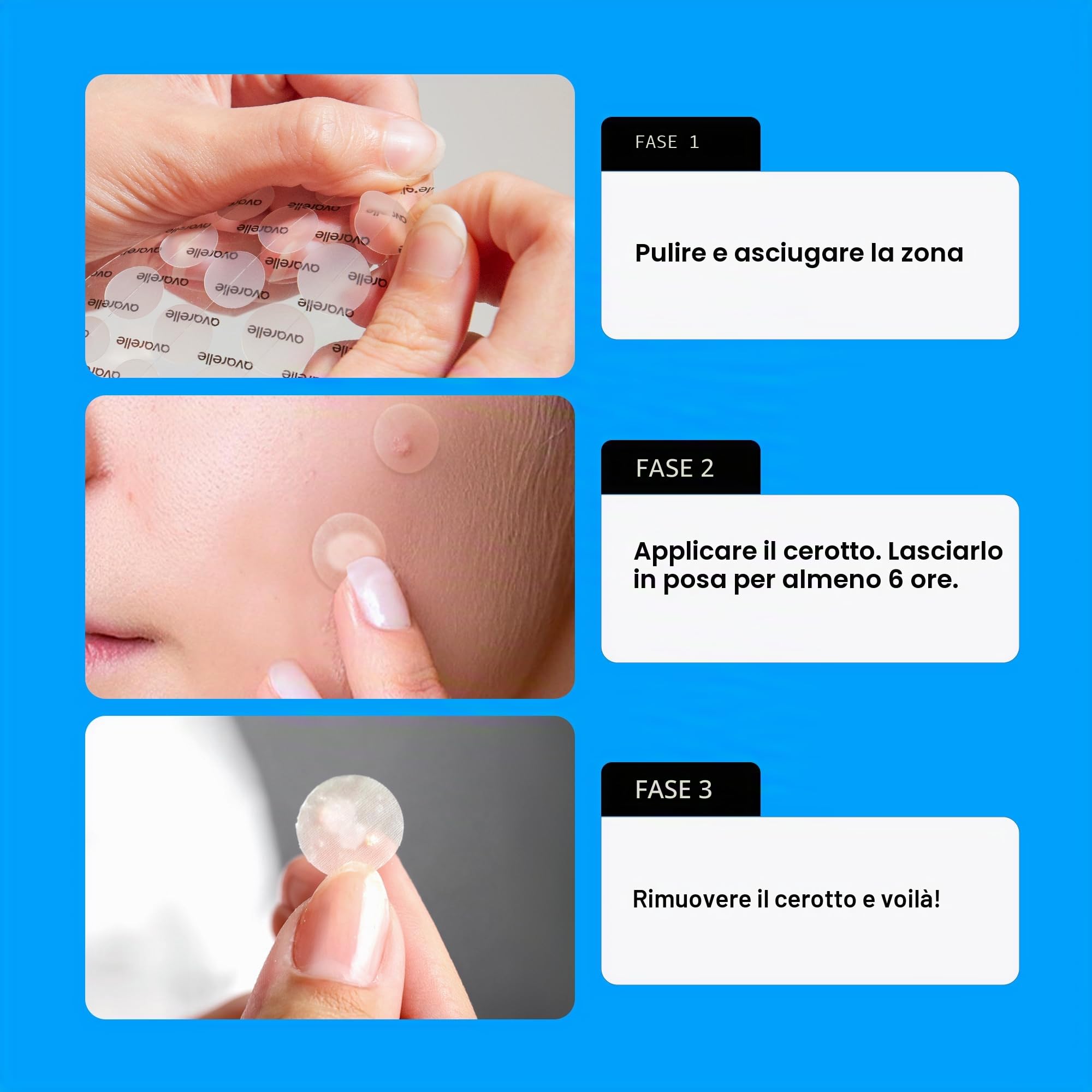AVARELLE Pimple Patches: Cerotti brufoli viso Hydrocolloidali con Olio di Tea Tree, Anti-acne, Vegan e Cruelty-free, ideali per trattamento mirato di brufoli e imperfezioni, skincare coreana