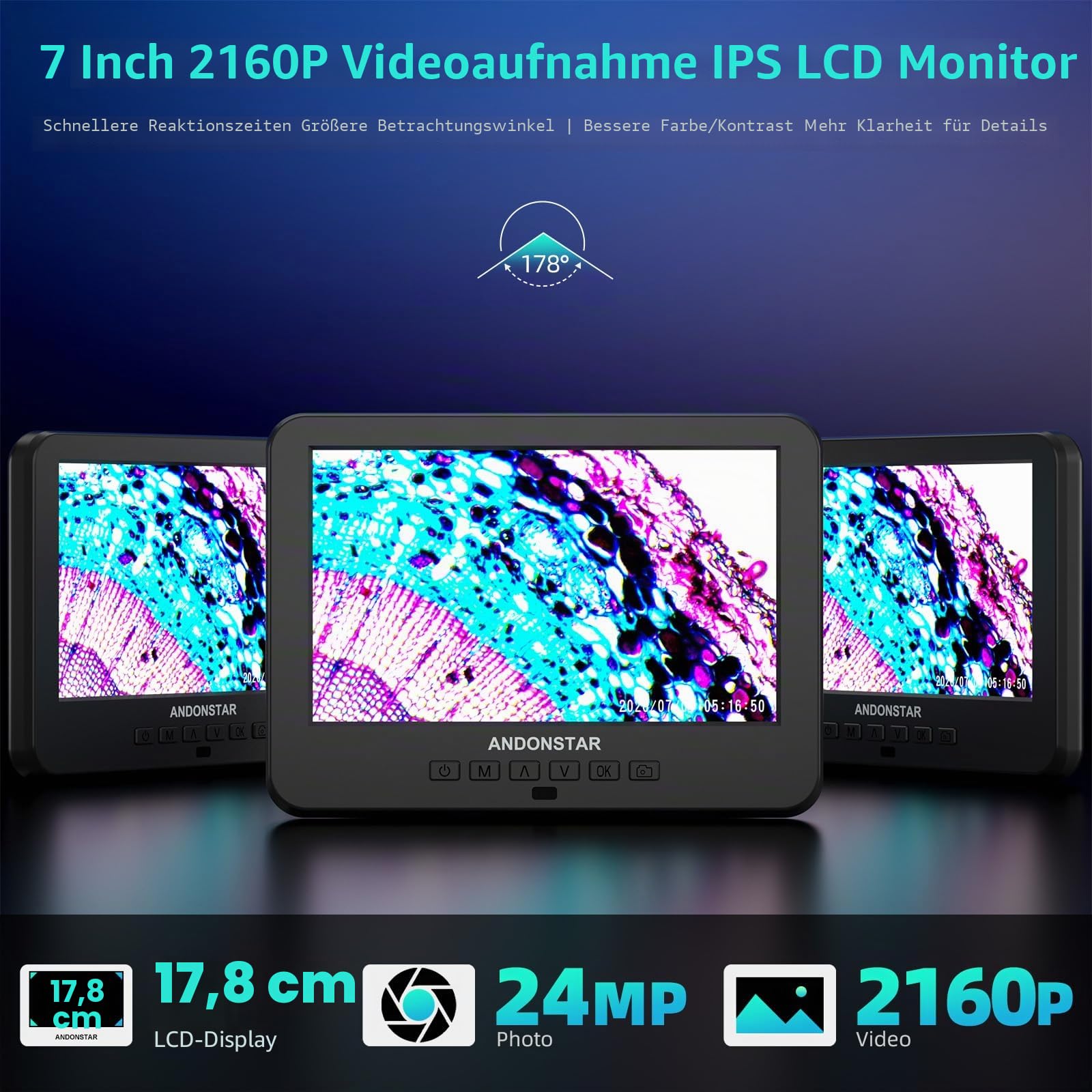 Andonstar AD266S 20X-5000X HDMI Digitales Mikroskop, 5-Linsen 2160P UHD Videoaufzeichnung, 17,8 cm LCD-Mikroskop für Erwachsene und Kinder, Heimlabor Biologisches Kit