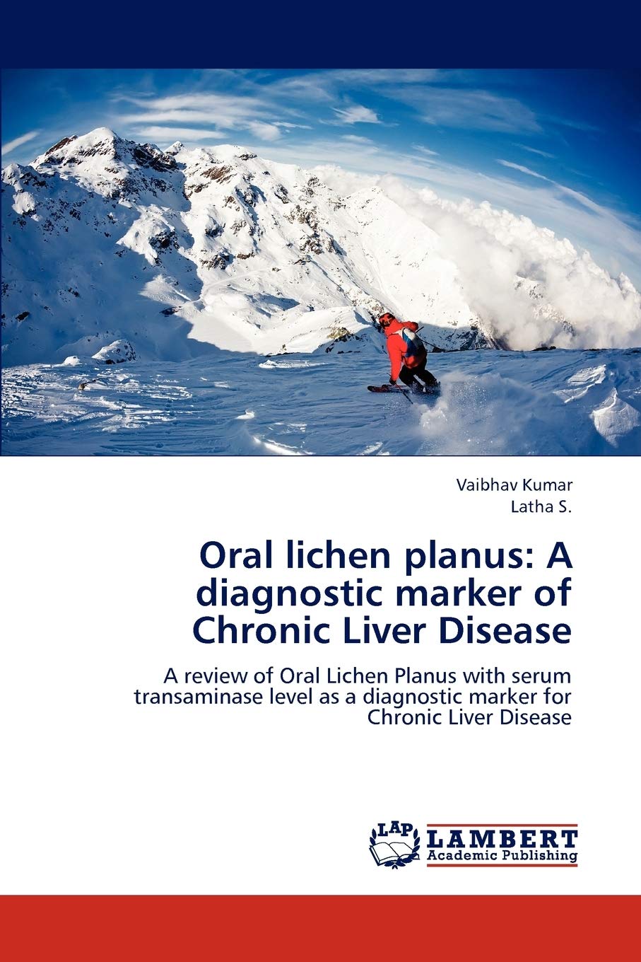 Oral lichen planus: A diagnostic marker of Chronic Liver Disease: A review of Oral Lichen Planus with serum transaminase level as a diagnostic marker for Chronic Liver Disease