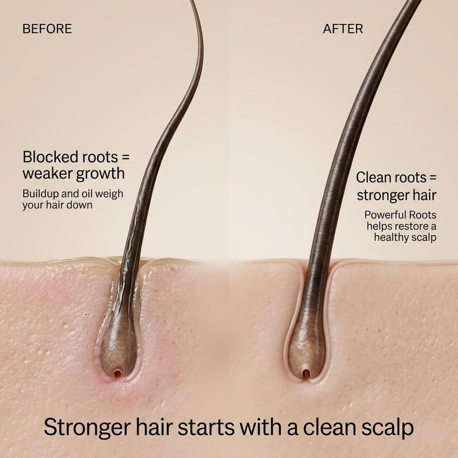 Powerful Roots Hair Growth Serum – Natural 4 oz Biotin and Brazilian Ginseng Formula with Arnica & Castor Oil – Supports Thicker, Fuller Looking Hair and Scalp Health – Lightweight, Paraben-Free