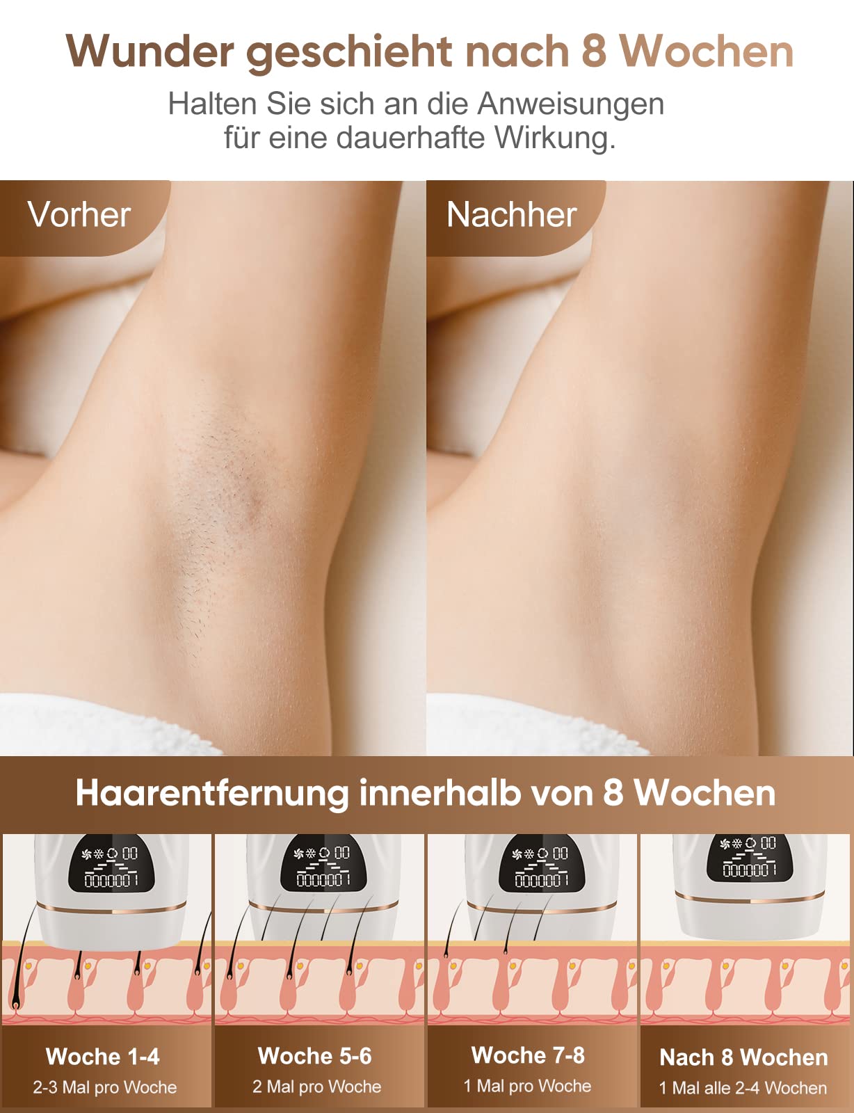 IPL Geräte Haarentfernung Laser Mit Gefrierfunktion 9 Energiestufen 1000,000 Lichtimpulse Dauerhafte Schmerzlose Haarentfernung für Männer Frauen Gesicht Achseln Beine Körper