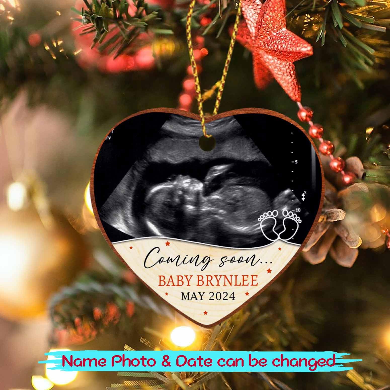 Personalized Baby Coming Soon Ornament Christmas, Baby Kids First Xmas Keepsake Custom Name & Picture, Newborn New Baby Ornament Gifts for Pregnancy Announcement, 2025 Christmas Ornaments Add Photo