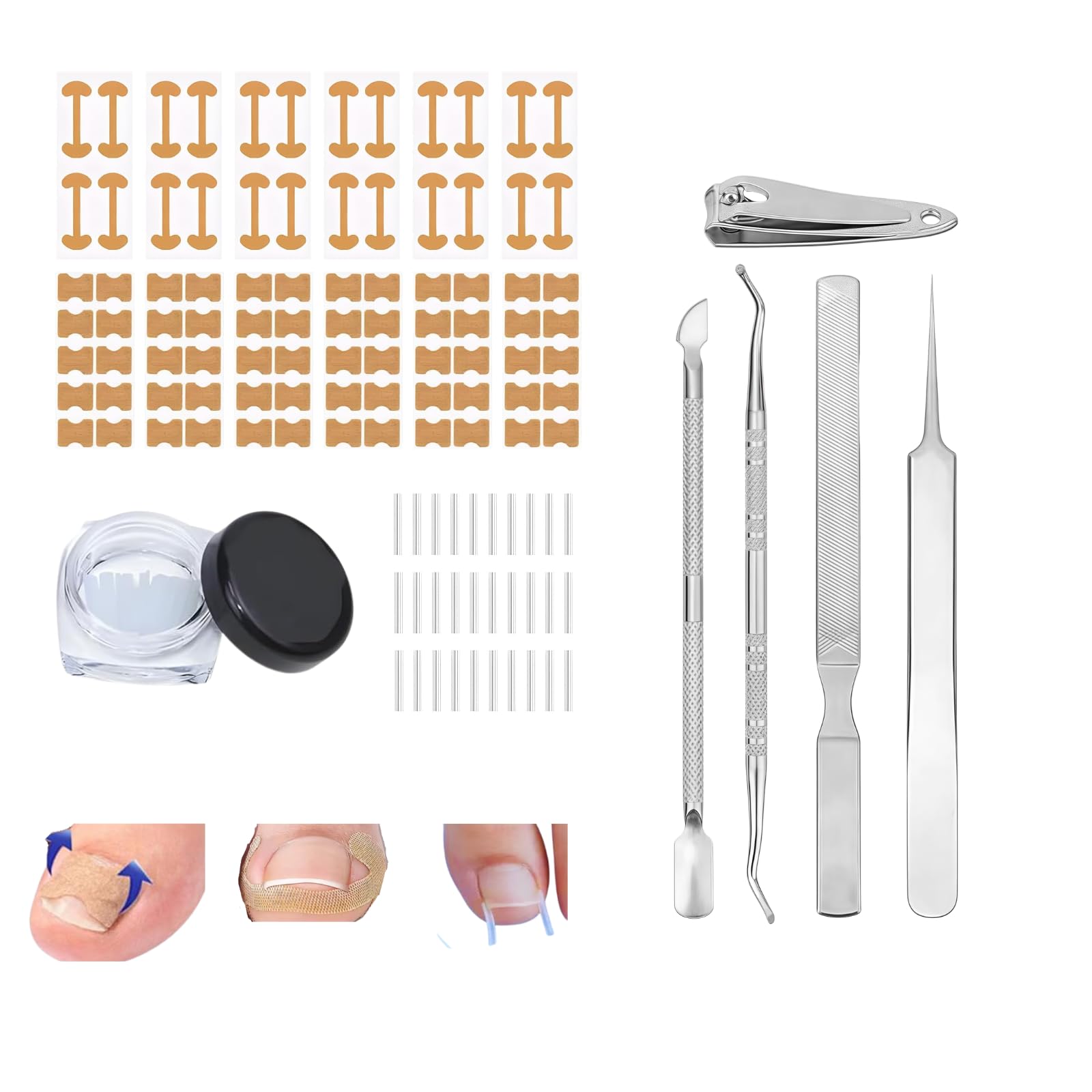 Ingrown Toenail Corrector Set with Curved Toenail Correction Patch, Upgraded Nail Removal Kit, Pedicure Tools for Home Treatment