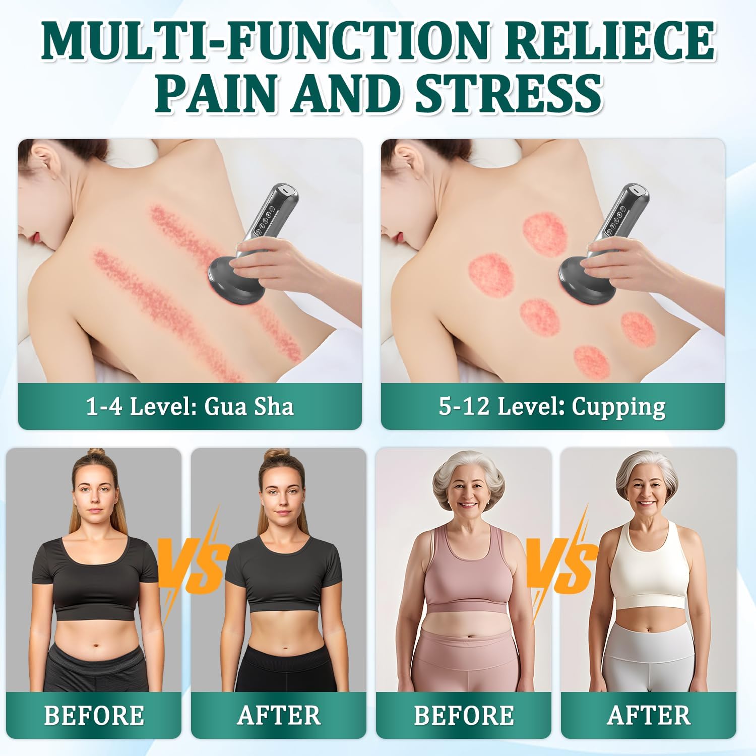Appareil de Massage contre la Cellulite, 12 Vitesse Réglable, Appareil de Sculpture de la Cellulite pour le Corps, Ensemble de Thérapie de Suction Electrique Intelligent, Rechargeable & Sans Fil (B)