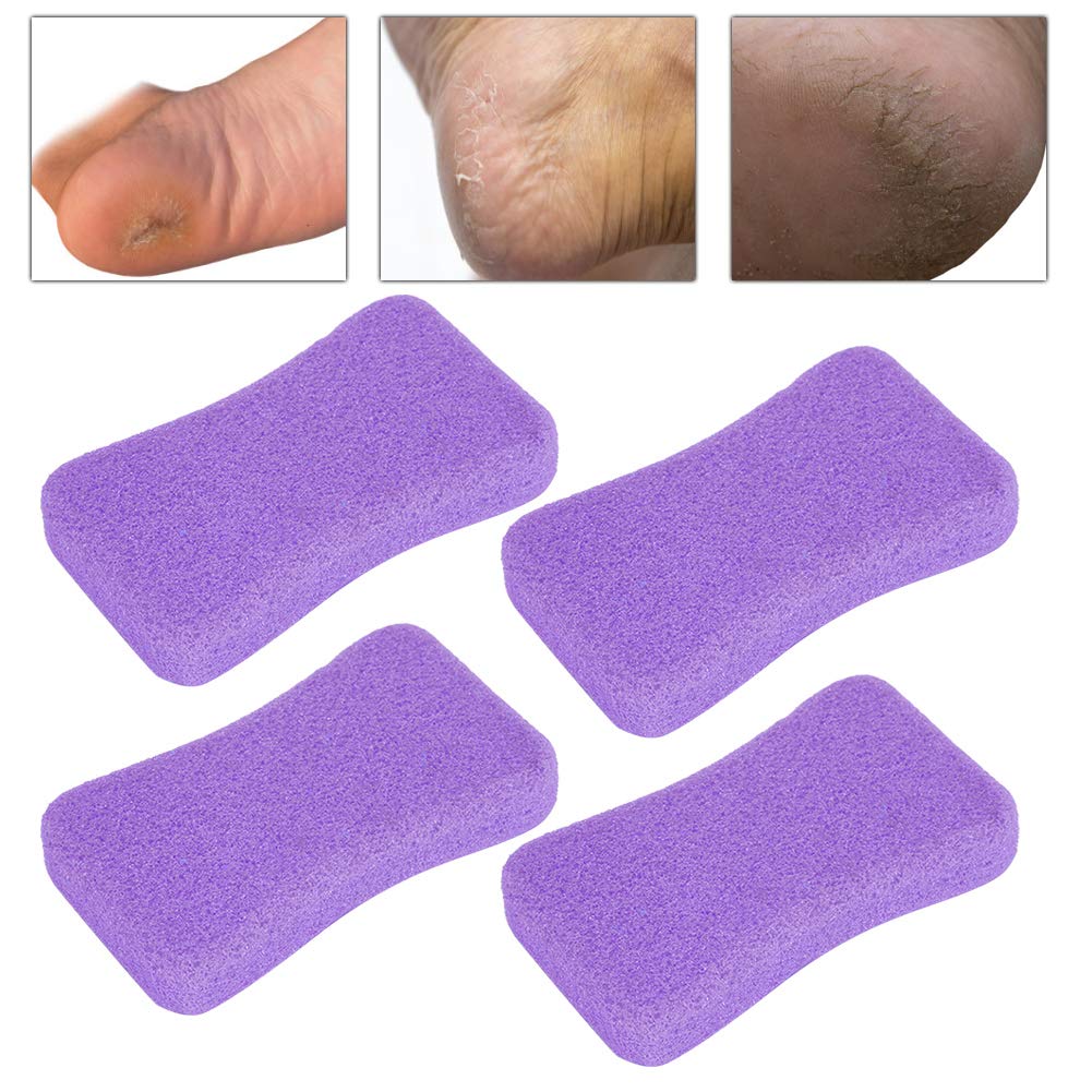 Piedi Pietra pomice - 4 pezzi Cura dei piedi Callus Pietra esfoliante Piedi Pelle dura Rimuovi pedicure Scrubber(Viola)