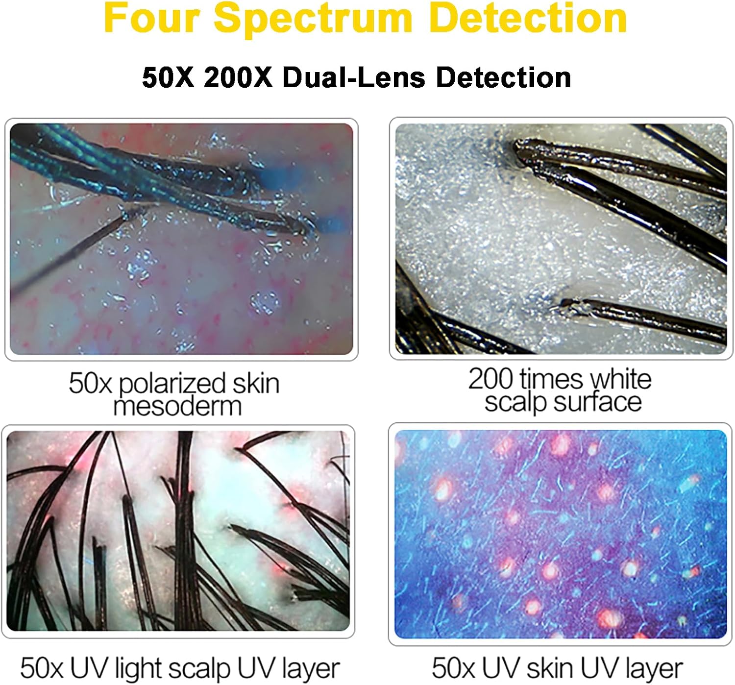 Four Spectrum Skin Hair Scalp Analyzer, 17 Inch Screen Hair Follicle Detector, with 50X 200X Lens and Remote Control, for Home, Salon, Beauty Salon,Standard Model