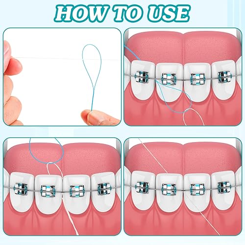 Miniatura 3 de 1000 enhebradores de hilo dental para frenos, puentes e implantes, enhebrador dental, diseño de bucle de nailon multifuncional para tus dientes