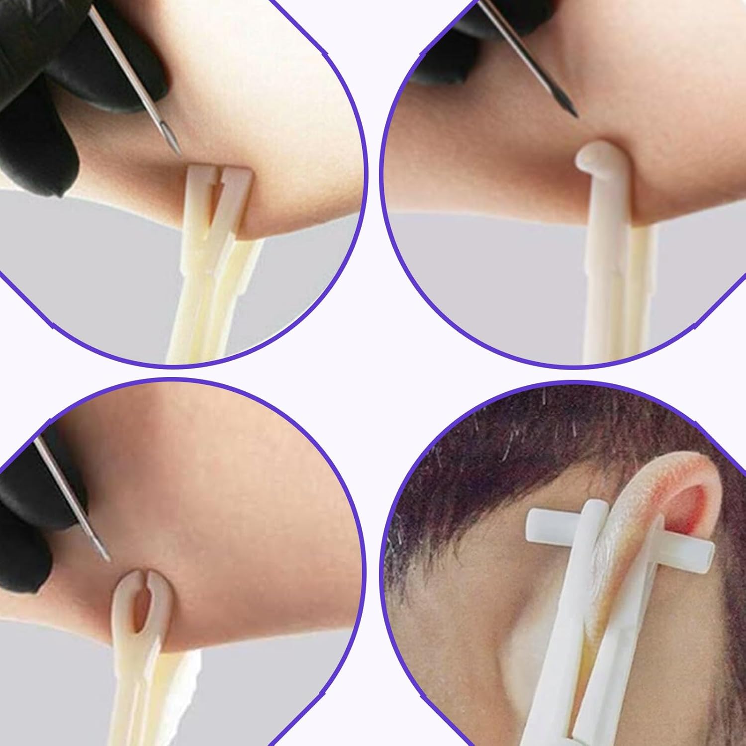 75PCS Piercing Clamps Kit - 50PCS Mixed Catheter Piercing Needles IV and 20PCS Piercing Forceps Disposable Piercing Clamps Septum Forceps and 5 Pairs of Gloves