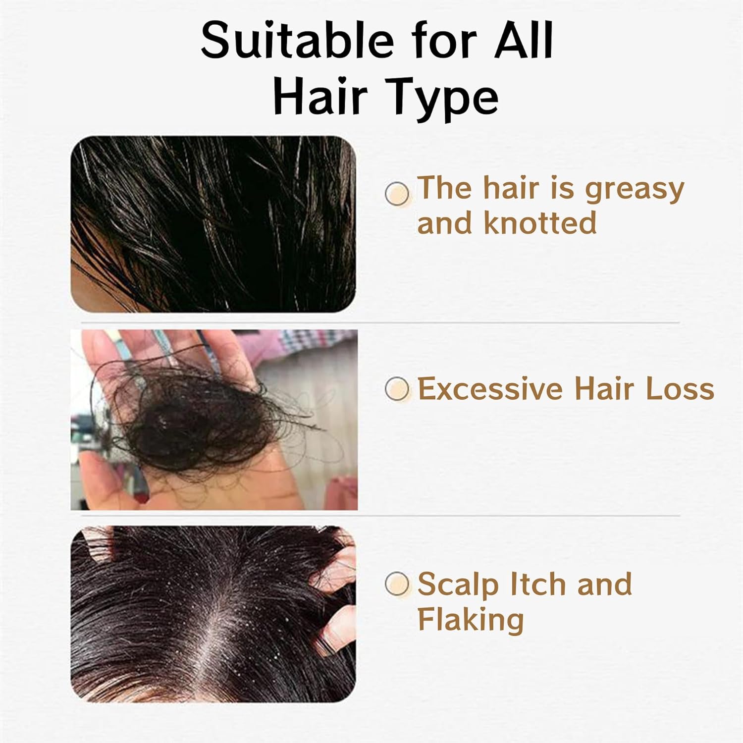 1 PCS Anti Hair Loss Shampoo, Promote Hair Growth and Thickening & Strengthening Shampoo with Various Plant Extracts for Thinning Hair Women（300ml） - Image 5