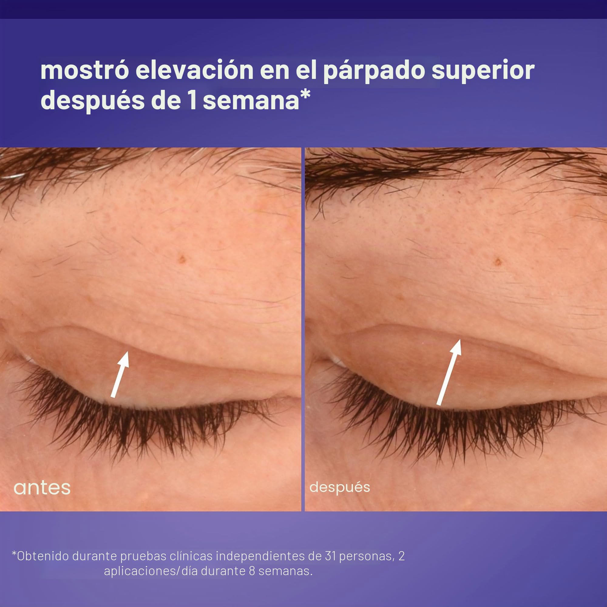 Dermalogica Phyto Nature Contorno de Ojos Efecto Lifting 15ml | Contorno de ojos con péptidos que ayuda a liftar, reafirmar y alisar el contorno del ojo.