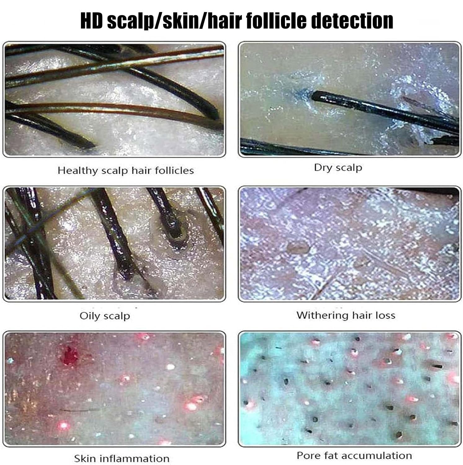 Haut Haar Analysegerät, Kopfhautanalysegerät, mit 11 Zoll HD LCD Bildschirm für Haut- und Haaranalyse, Analysegerät Multifunktionaler Digitaler Hautpflege-Analysegerät