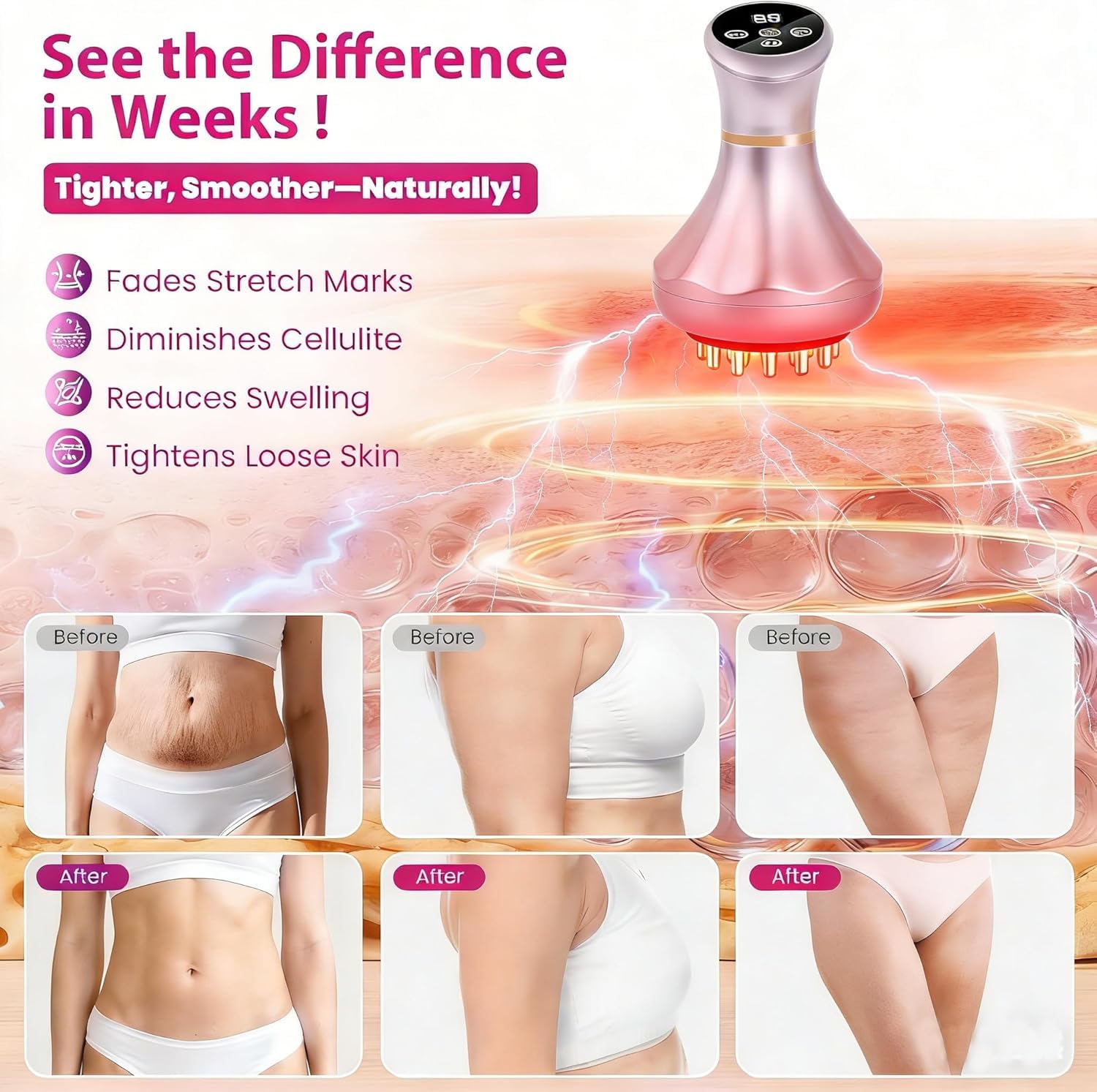 Nuevo Mi Jardin 4-in-1 Lymphatic Drainage Massager - Anti-Cellulite Tool with Heating/Vibration/Light Therapy, Cordless Handheld for Cellulite & Legs/Belly/Back/Hips Pain Relief & Skin Tightening