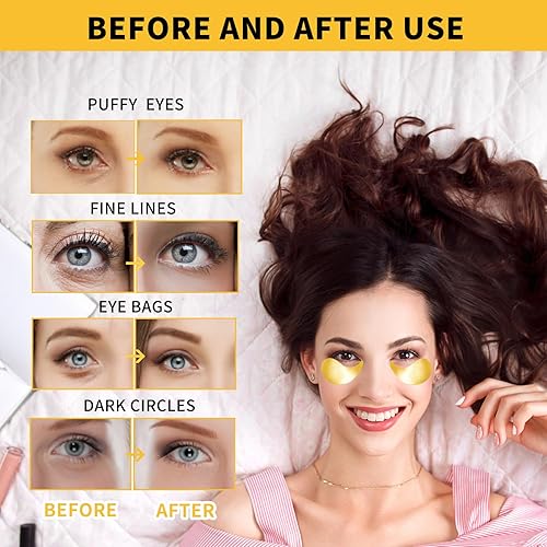 Miniatura 6 de Máscaras de ojos de oro de 24 quilates para ojeras e hinchazón, 70 unidades, parches debajo de los ojos, almohadillas de gel para tratamiento