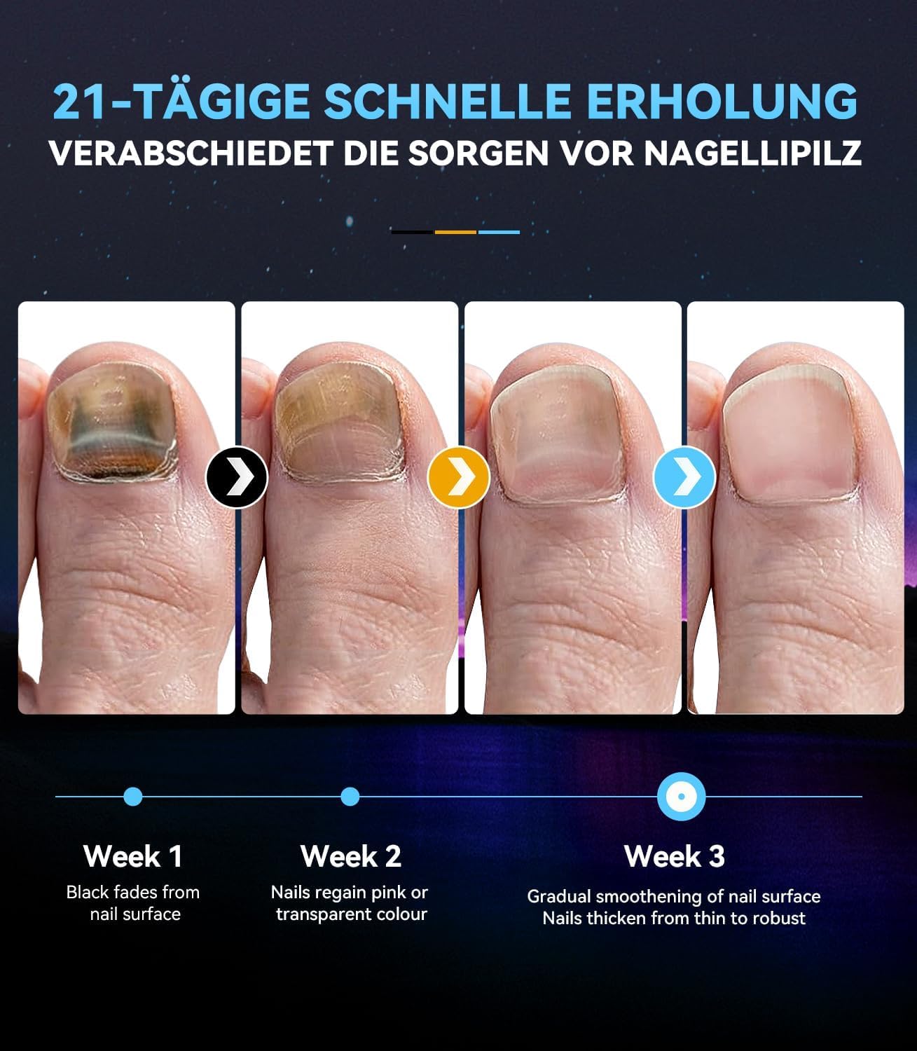 Nagelpilz Lasergerät 【21-Tage schnell】【905nm Rottlicht-Technologie】Nagelpilz Testsieger mit Timer (30s/60s/99s) Für Finger & Zehen Blau