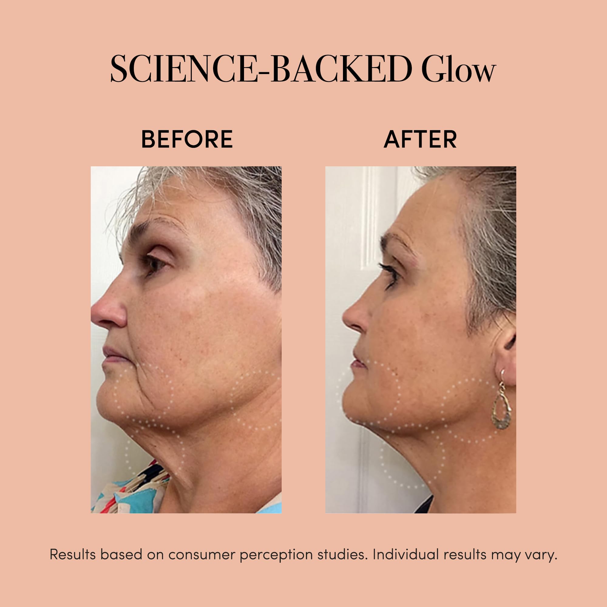 Amazon.com: reVive Light Therapy reVive Lux Collection Glo Aging