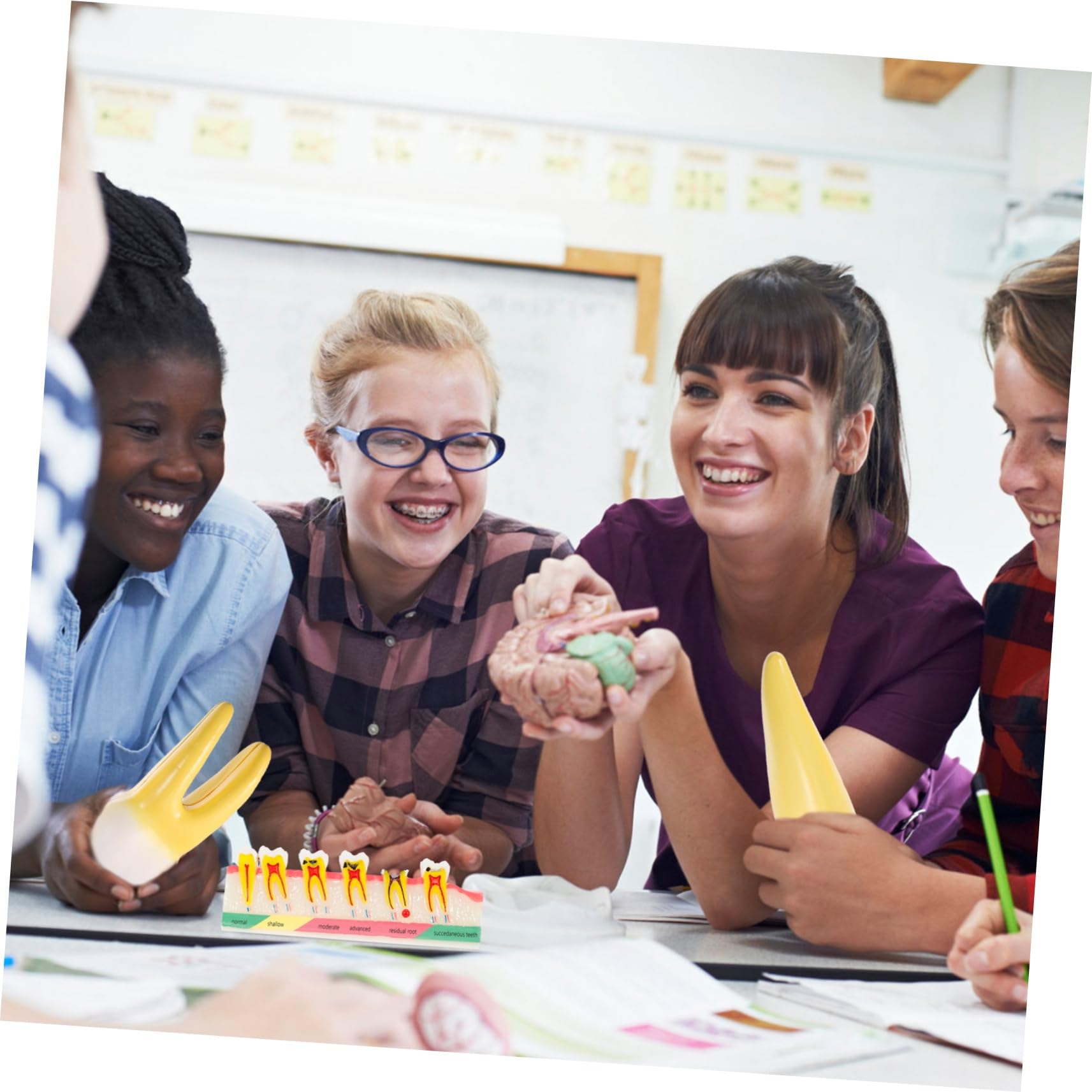 Alipis Modello Didattico di Denti Carie Resistente per Corsi Odontoiatrici, Strumento Dimostrativo per Studio e Lezioni di Igiene Orale, Modello Educativo Professionale per Studenti