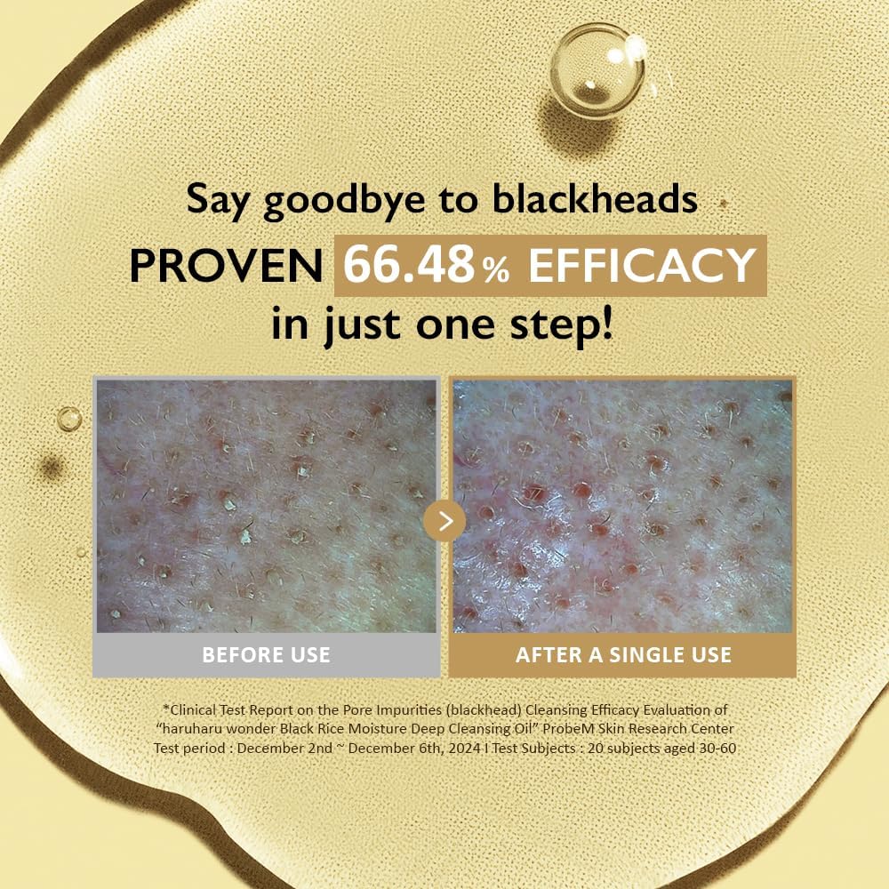 Innerest HARUHARU wonder Black Rice Moisture Cleansing Oil, Double Cleansing, Daily Makeup remover, Pore Oil Cleanser, Korean Skincare for sensitive, normal and Oily Skin, 5.1 fl oz