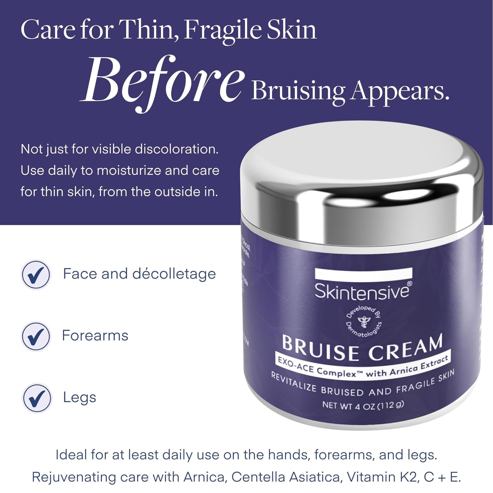 SKINTENSIVE Arnica Bruise Cream for Thin Skin – Vitamin K Cream for Bruises & Skin Discoloration, Moisturizing Arnica Cream, Non-Greasy Formula, 4 Oz — Amazon image 2