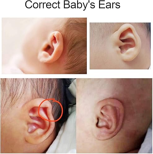 Miniatura 3 de Parche de corrección de aurícula valgus para bebés, correctores estéticos de orejas para bebés recién nacidos, adhesivos para parches de orejas