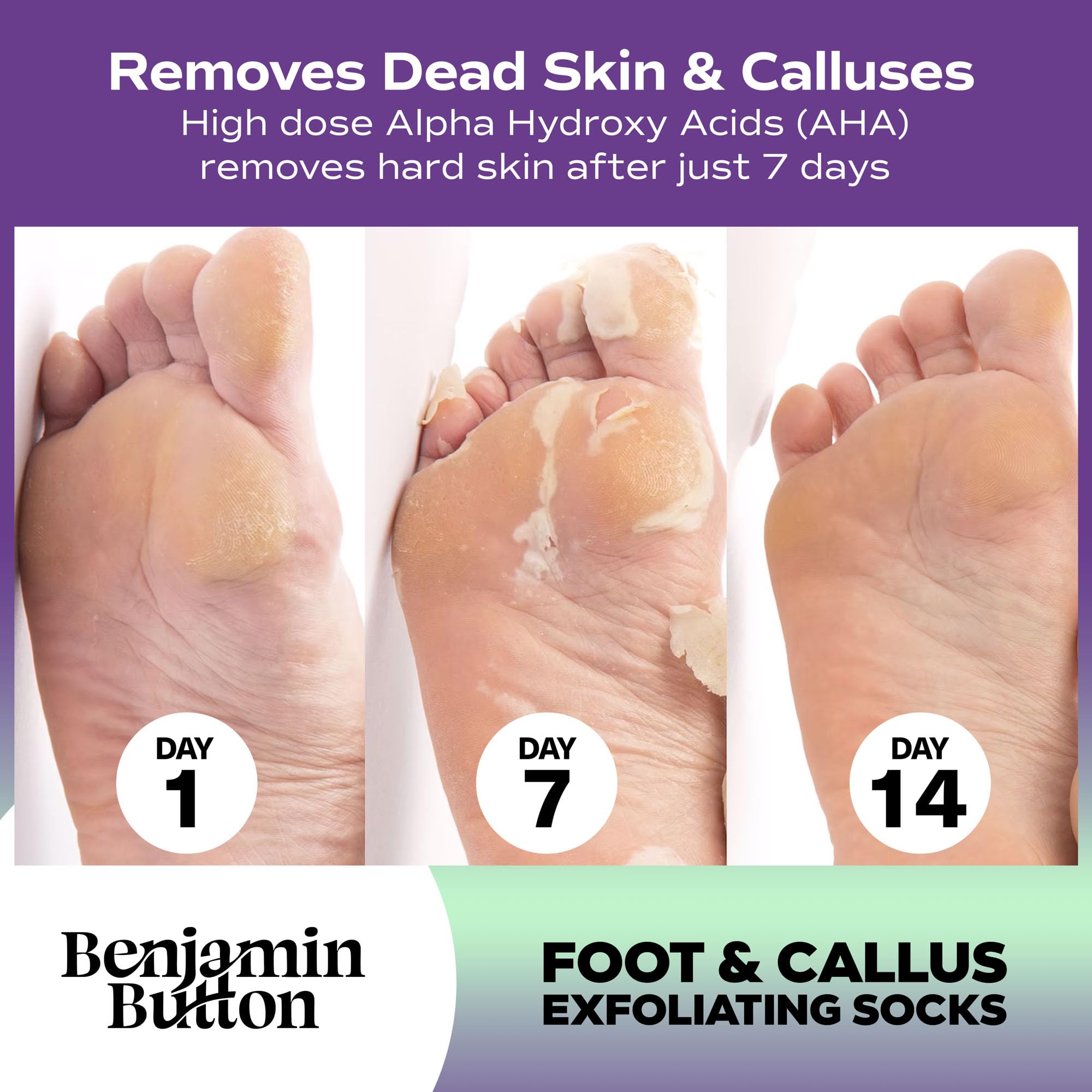 Benjamin Button Luxury Foot Peel Mask - 5x works, 1 count (Pack of 5) - Image 2