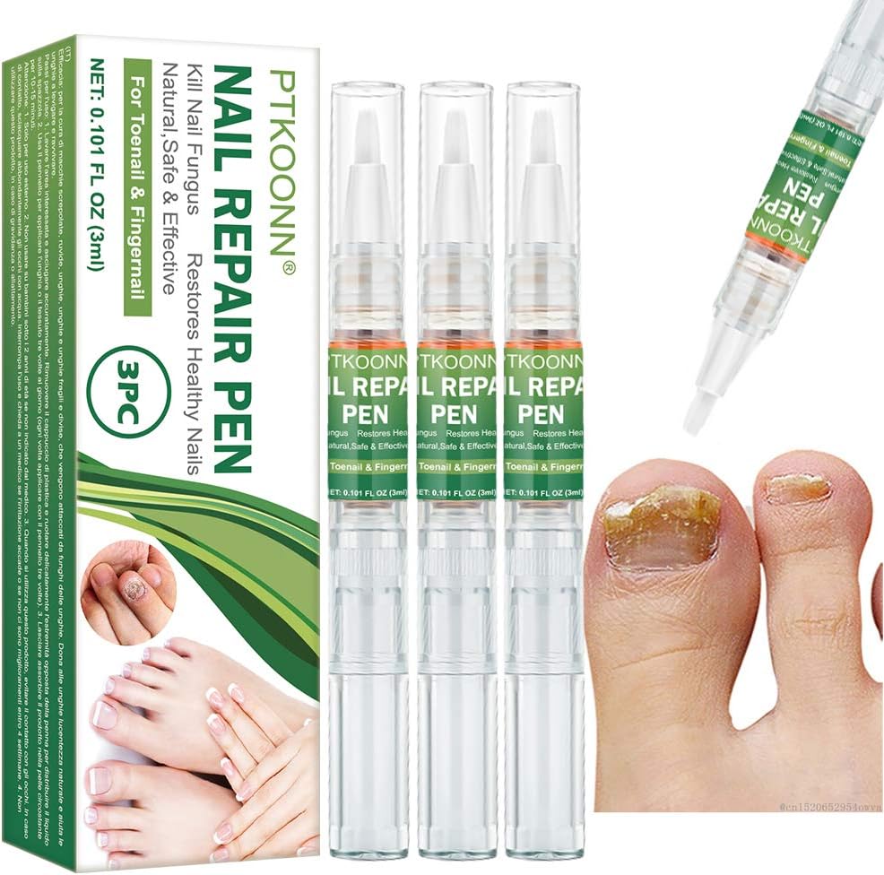 trattamento dei funghi delle unghie per gli esseri umani