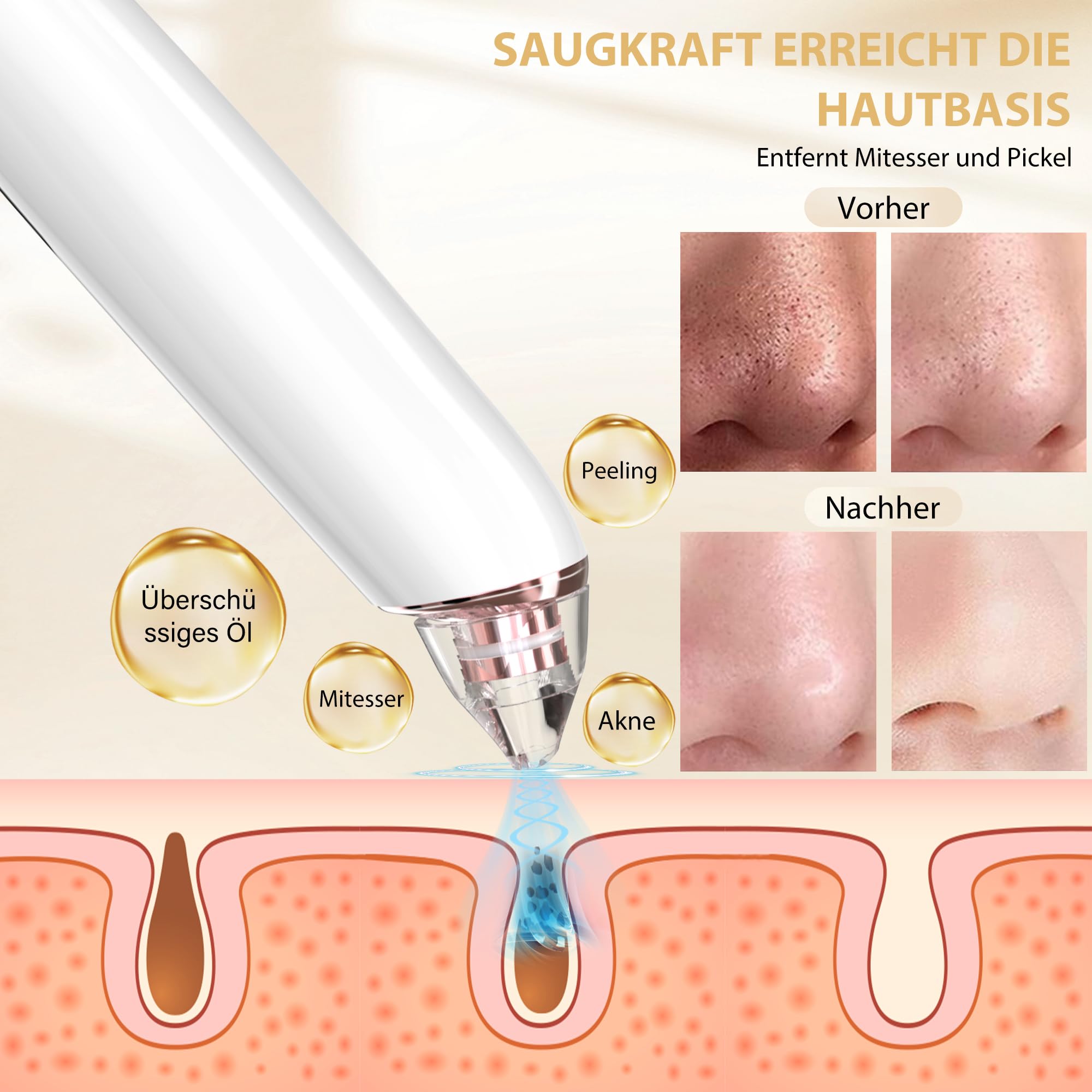 Porenreiniger Gesicht Mitesserentfernung, Porensauger Gesicht Mitesser Entferner Sauger Nase Akne Pickelsauger mit 3 Saugstufen und 6 Köpfe Blackhead Remover Pickelentferner - 5