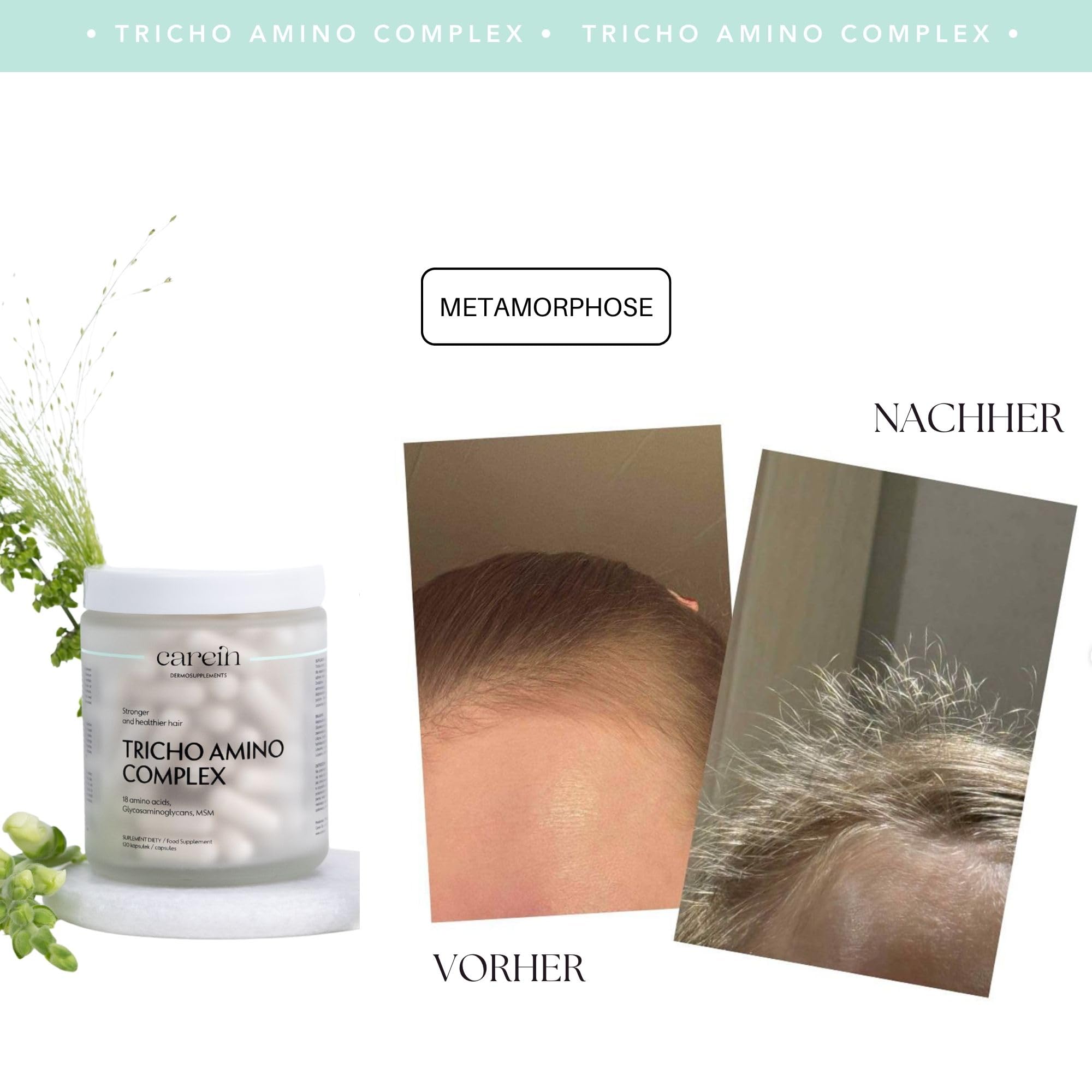 Tricho Amino Complex - Haarwachstum Nahrungsergänzung mit Aminosäuren, MSM & Biotin - Reduziert Haarbruch, Stärkt Haarstruktur - 120 Kapseln,30-Tage-Vorrat - Professionelle Trichologie-Formel - Carein