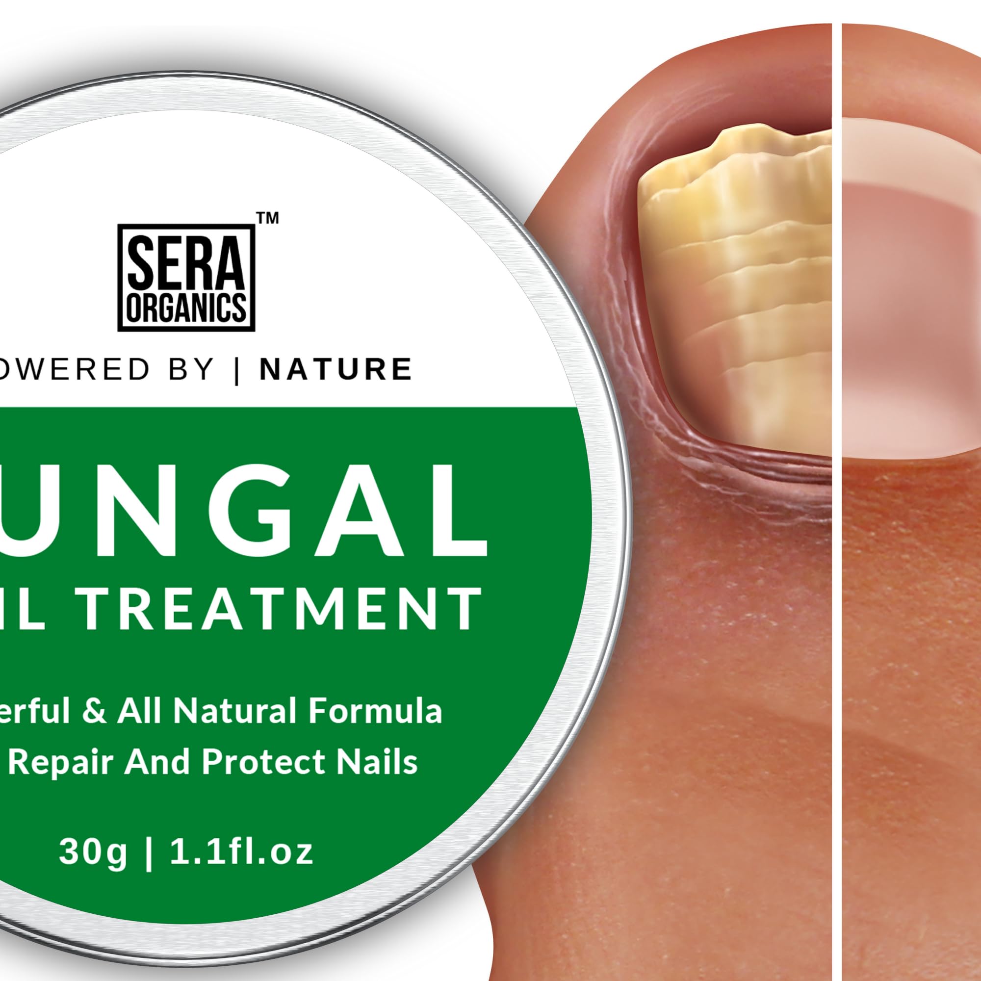 Fungal Nail Treatment Cream - Image 4