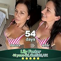 Vista 3 de Lotmay - Gotas orales de péptido de colágeno, péptidos de colágeno múltiple para mujeres, péptidos de colágeno líquido hidrolizados para levantar