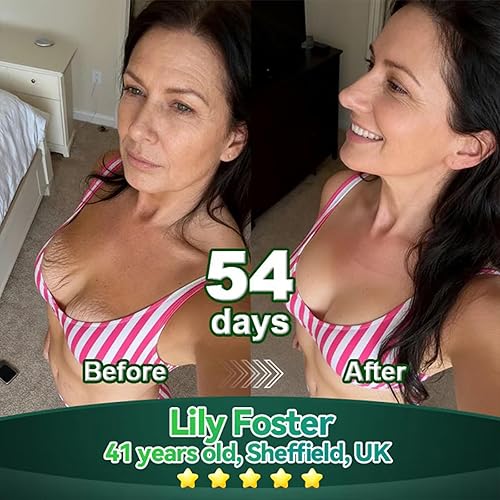 Miniatura 3 de Lotmay - Gotas orales de péptido de colágeno, péptidos de colágeno múltiple para mujeres, péptidos de colágeno líquido hidrolizados para levantar y