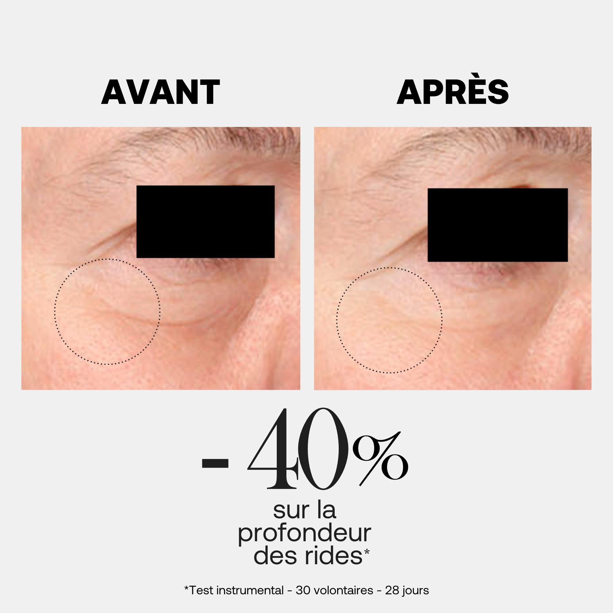 Rexaline X-treme Corrector - Soin Expert Yeux Anti-Âge - Crème contour des yeux anti ride - Anti cerne homme et femme - Anti poches yeux - Patte d'oie - Duo Acide Hyaluronique - Cruelty free - 15ml