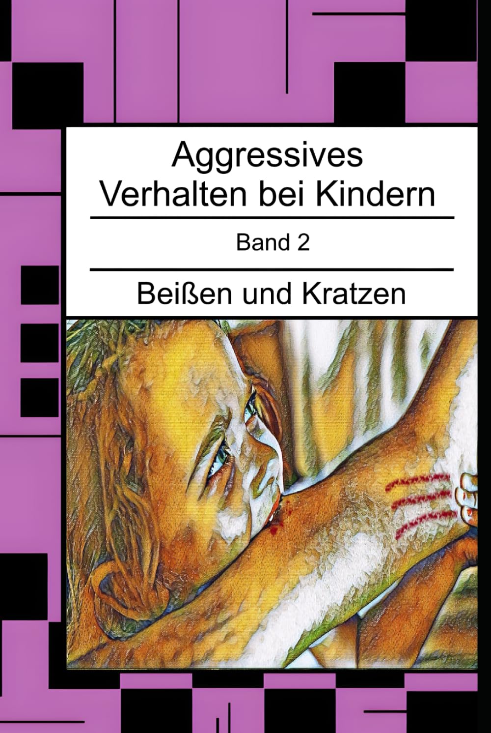 Aggressives Verhalten bei Kindern: Beißen und Kratzen (Aggressives Verhalten bei Kindern - erkennen, einordnen und verstehen)