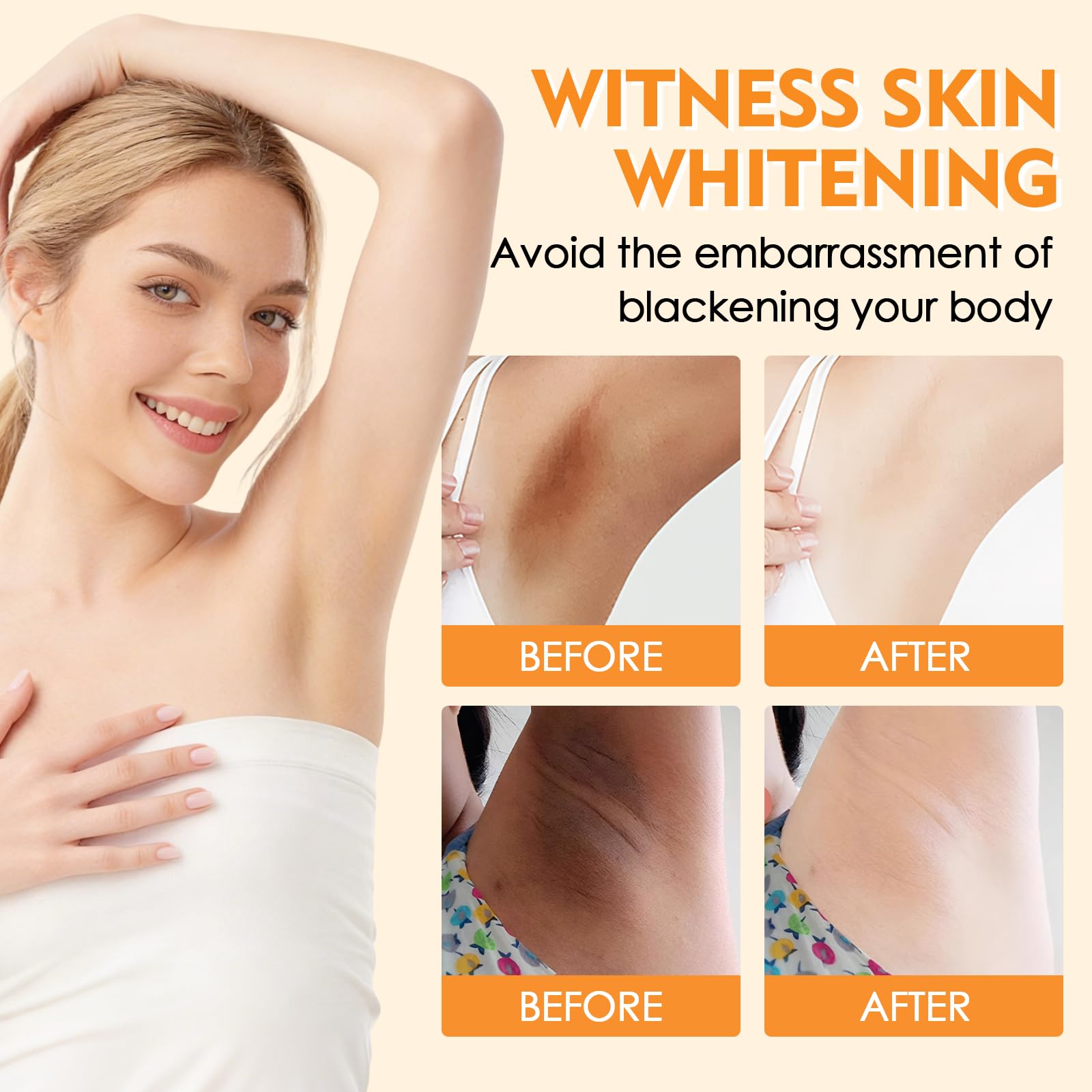 Crema Blanqueadora Axilas,Crema Aclaradora Zonas Íntimas y Muslos Internos,Crema Hidratante Blanqueante para Codos,Rodillas y Piel Sensible,Suaviza,Aclara Manchas Oscuras y Mejora Tono de Piel,60g - 5